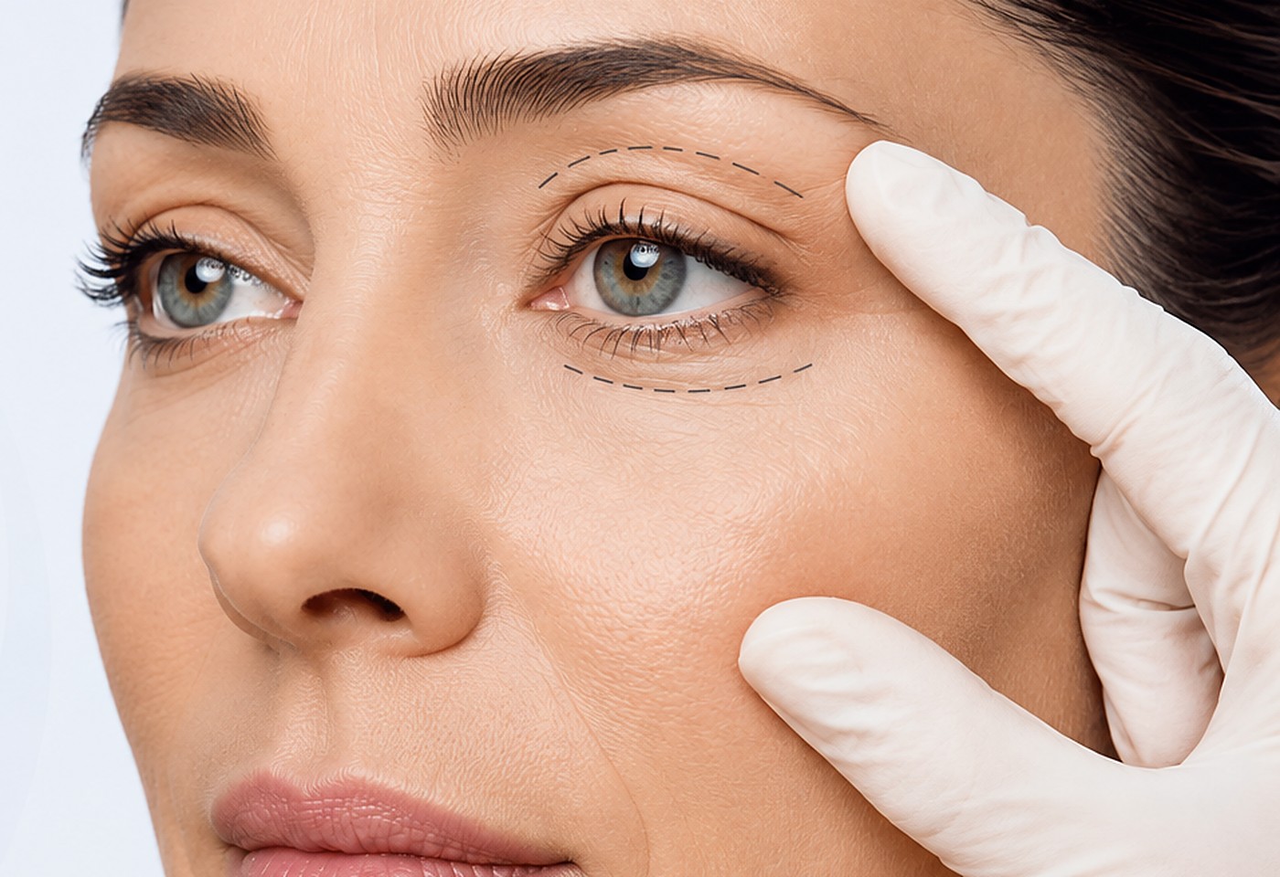 Plástica Ocular · Blefaroplastia - Clin Olhar